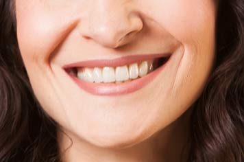 Schöne und ästhetische Zähne
